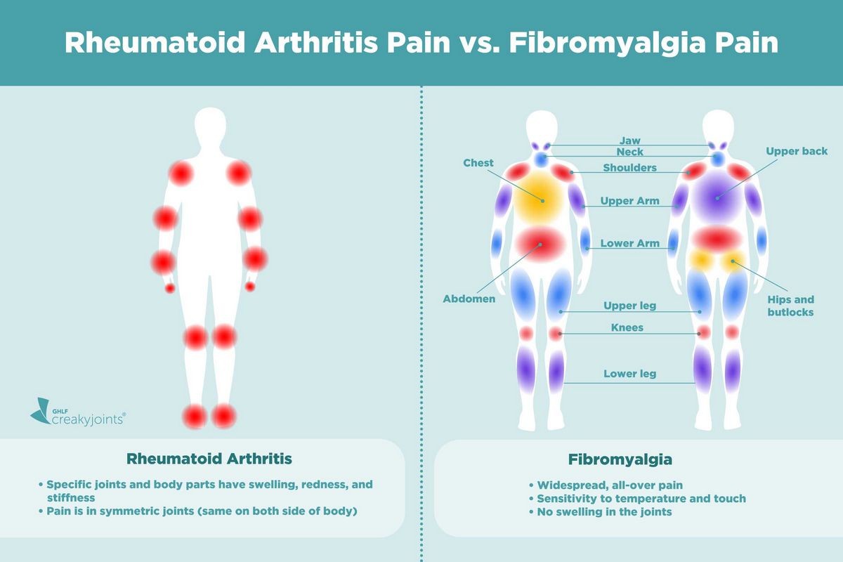 Rheumatoid Arthritis vs Polymyalgia Rheumatica Chart Causes Treatment