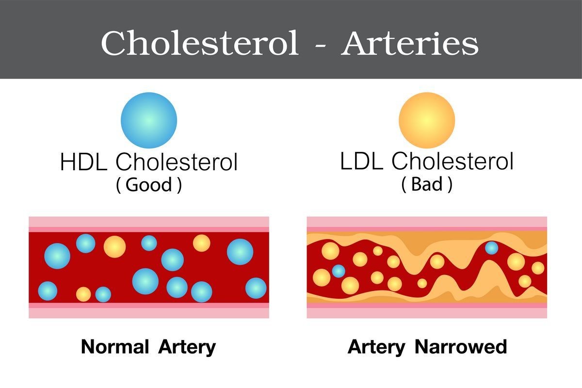 Statins - Doing More Than Lowering Your Cholesterol