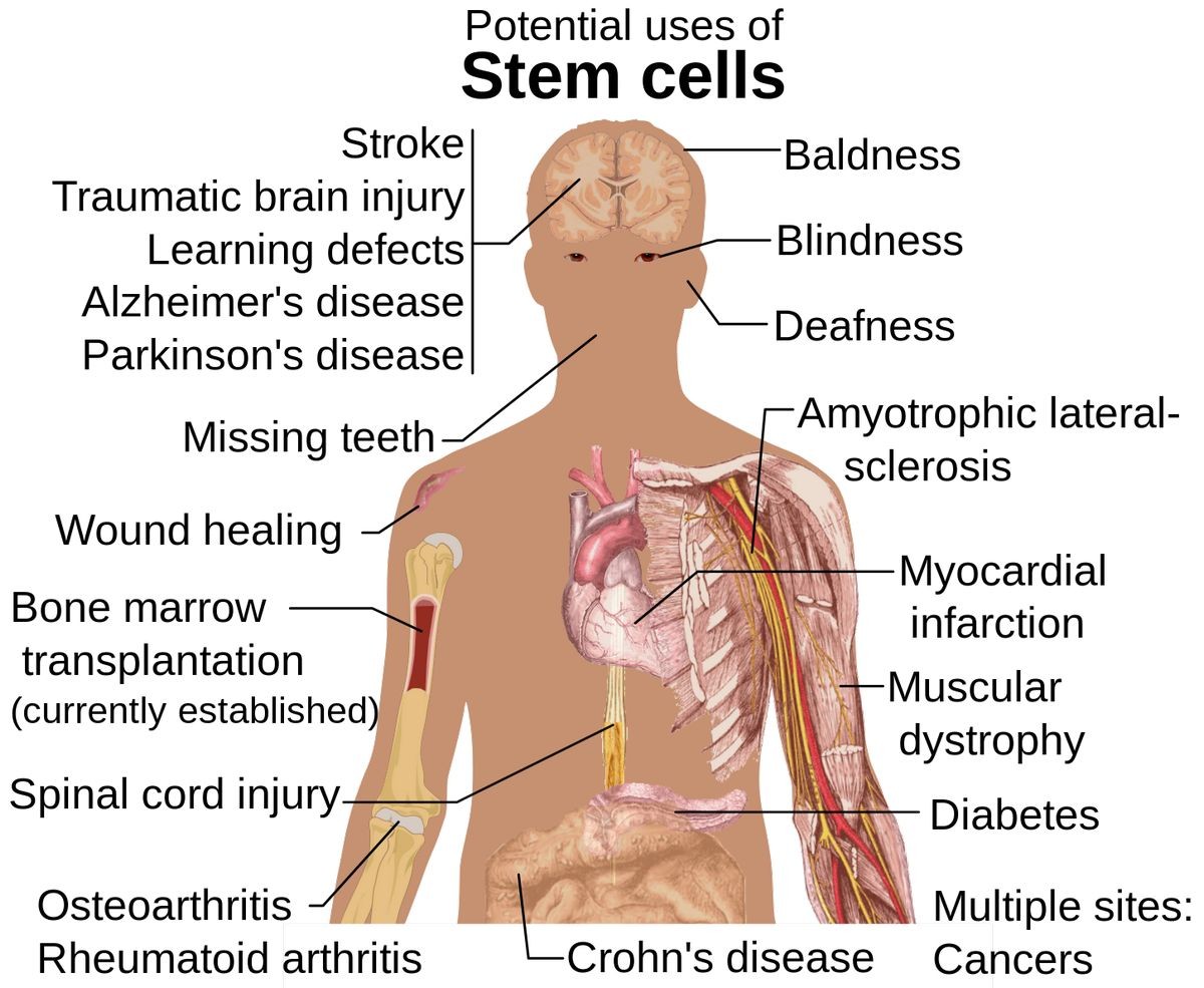 Stem Cells Therapy Function Treatment Uses