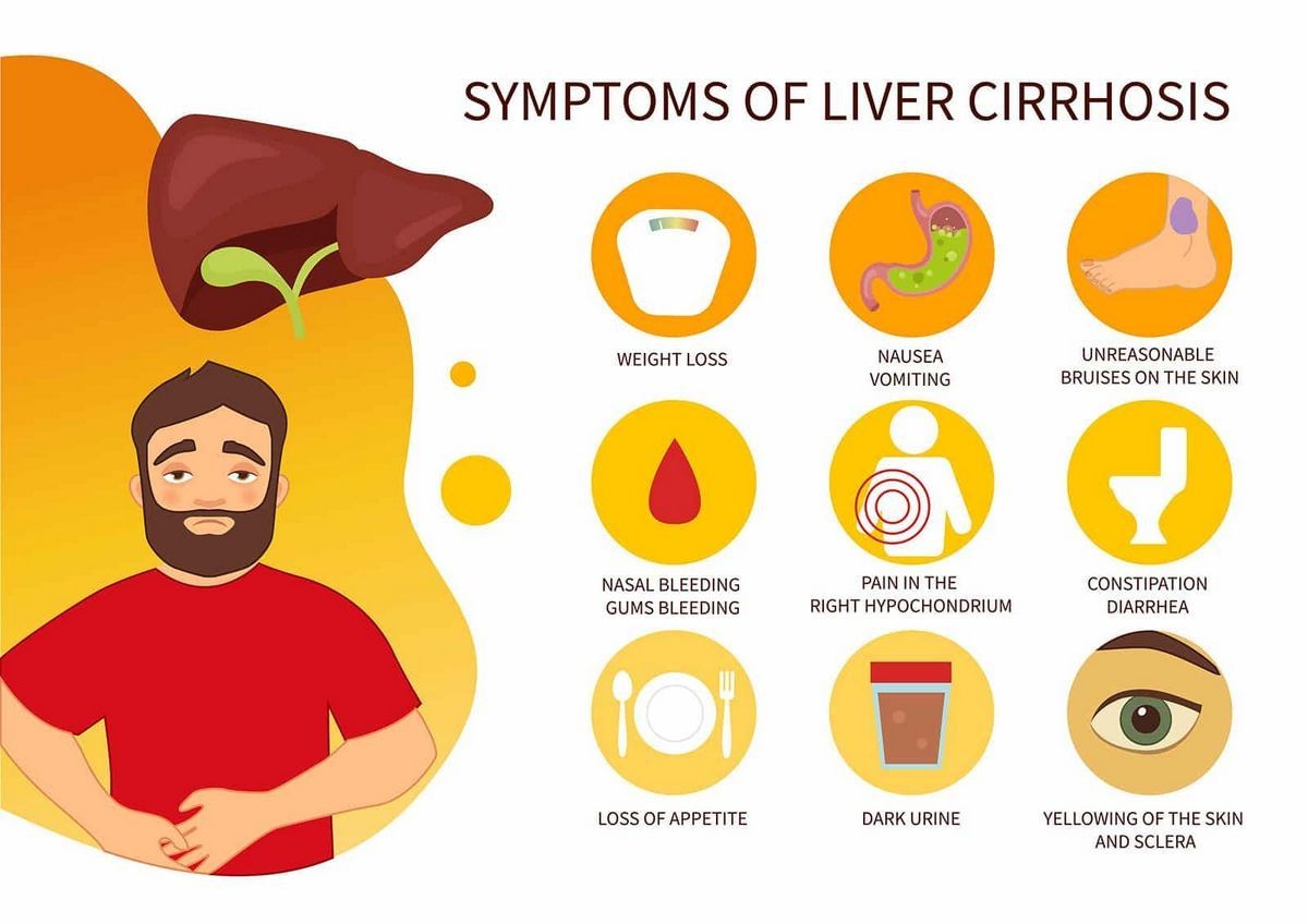 What Are the First Signs of Cirrhosis Symptoms Causes Treatment