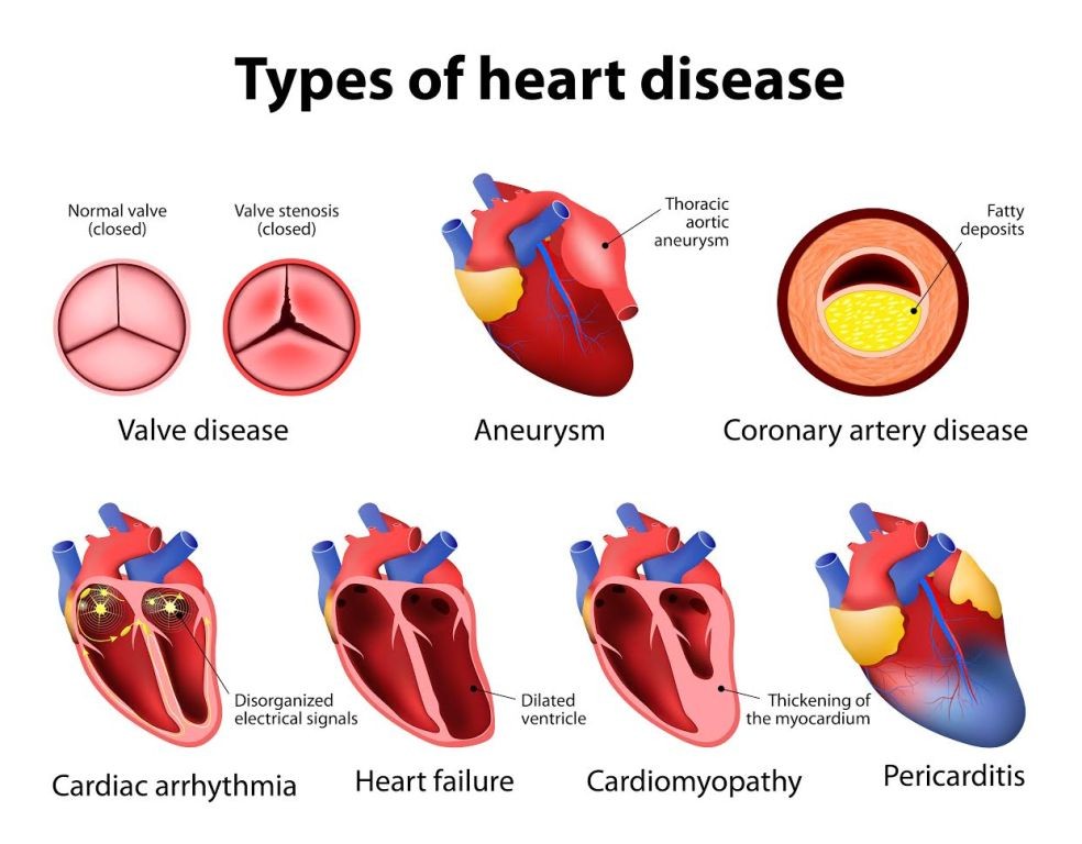 What Are the Four Main Functions of the Heart Common Heart Diseases