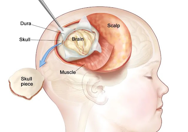 What Are the Symptoms of ATRT 6 Treatment Options