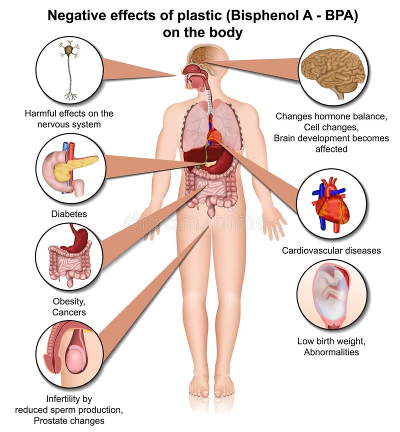 What Are the Symptoms of BPA Poisoning