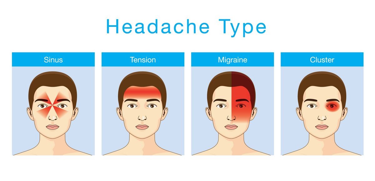 What Are the Types of Migraine Headache Medications