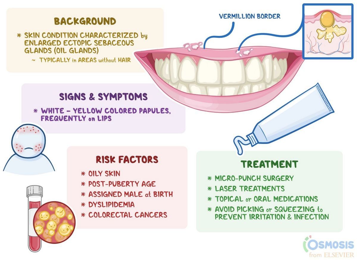 What Causes Fordyce Spots on Lips