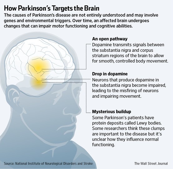 Zelapar for Parkinson s Disease Drug Side Effects Warnings